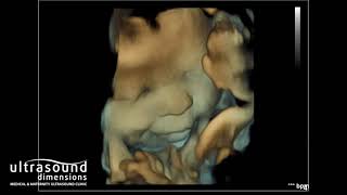 Scan of the Week: 35 week 3D\/4D Baby Scan