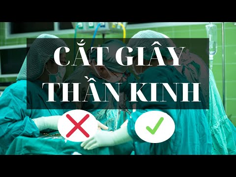 Cắt hạch thần kinh giao cảm, cắt tuyến mồ hôi tay chân nách?//[LIPLOP]