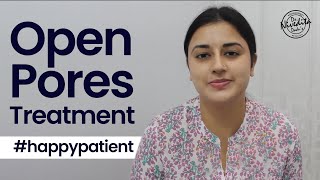 Patient Testimonials | Open Pores Treatment| Dr. Nivedita Dadu's Dermatology Clinic