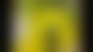 Circumferential antral ESD of the early gastric cancer