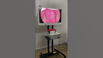 Karl Storz Image 1 S / Spies with 32” 4K Monitor | Vision Clarity #laparoscopicsurgeon #4k #spies