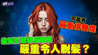 染髮引起頭皮敏感 嚴重令人脫髮？更有可能有嚴重併發症！｜ 健康關注組｜ EP261｜ 染髮 ｜ 頭皮敏感 ｜ HOY 77