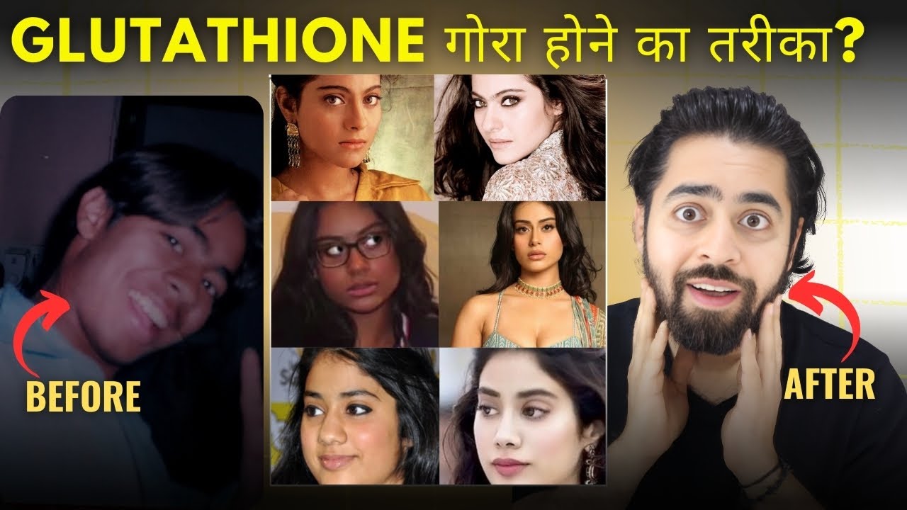 glutathione kya hota hai Glutathione: Health Benefiits, Side Effects and Dosage Info main image 1