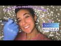 I took microneedling training at dermani medspa