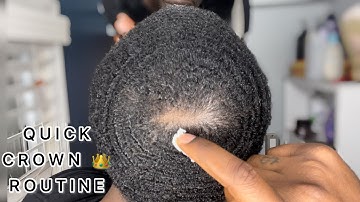 HOW TO GET WAVES: 360 WAVES CROWN METHOD || COARSE HAIR