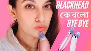 ব্লাকহেডস কিভাবে রিমুভ করলাম? / Pore Vacuum Machine or Blackhead Remover Machine