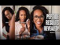 The Needle, The Ritual, The Glow | Why I Started Peptides