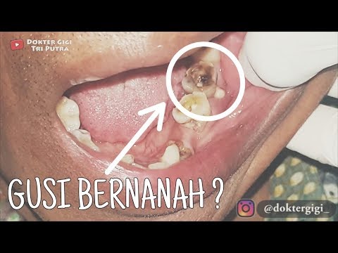 Bahayakah Rahim Sakit saat Hamil Muda? Apa yang Perlu Diwaspadai?. 