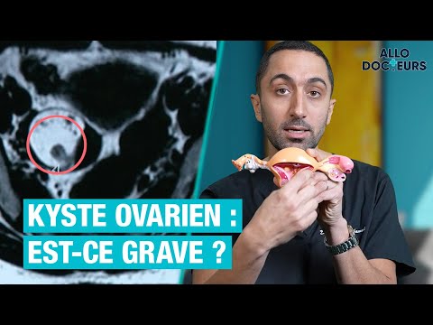 Vidéo: 3 façons de prévenir les kystes