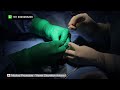 Testicular Sperm Extraction | Step-by-Step Surgical Procedure | kannada