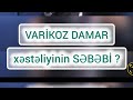 Varikoz damar xesteliyinin sebebi sebebleri damar cerrahi fleboloq ismayil esgerov icbari sigorta