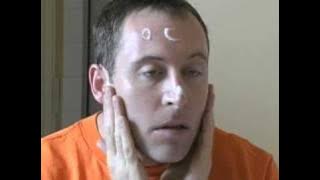 Applying benzoyl peroxide on The Acne.org Regimen