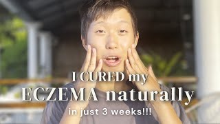 How I CURED my ECZEMA NATURALLY | Without Steroid Creams | 3 things I did to Transform my Health