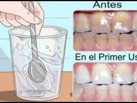 SOLO USE UNA GOTA DE ESTE REMEDIO Y BLANQUEO MIS DIENTES, ELIMINO EL SARRO entretenimiento en puerto rico