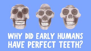 Why do we have crooked teeth when our ancestors didn’t? Why Do We Have Crooked Teeth When Our Ancestors Didn T G Richard Scott