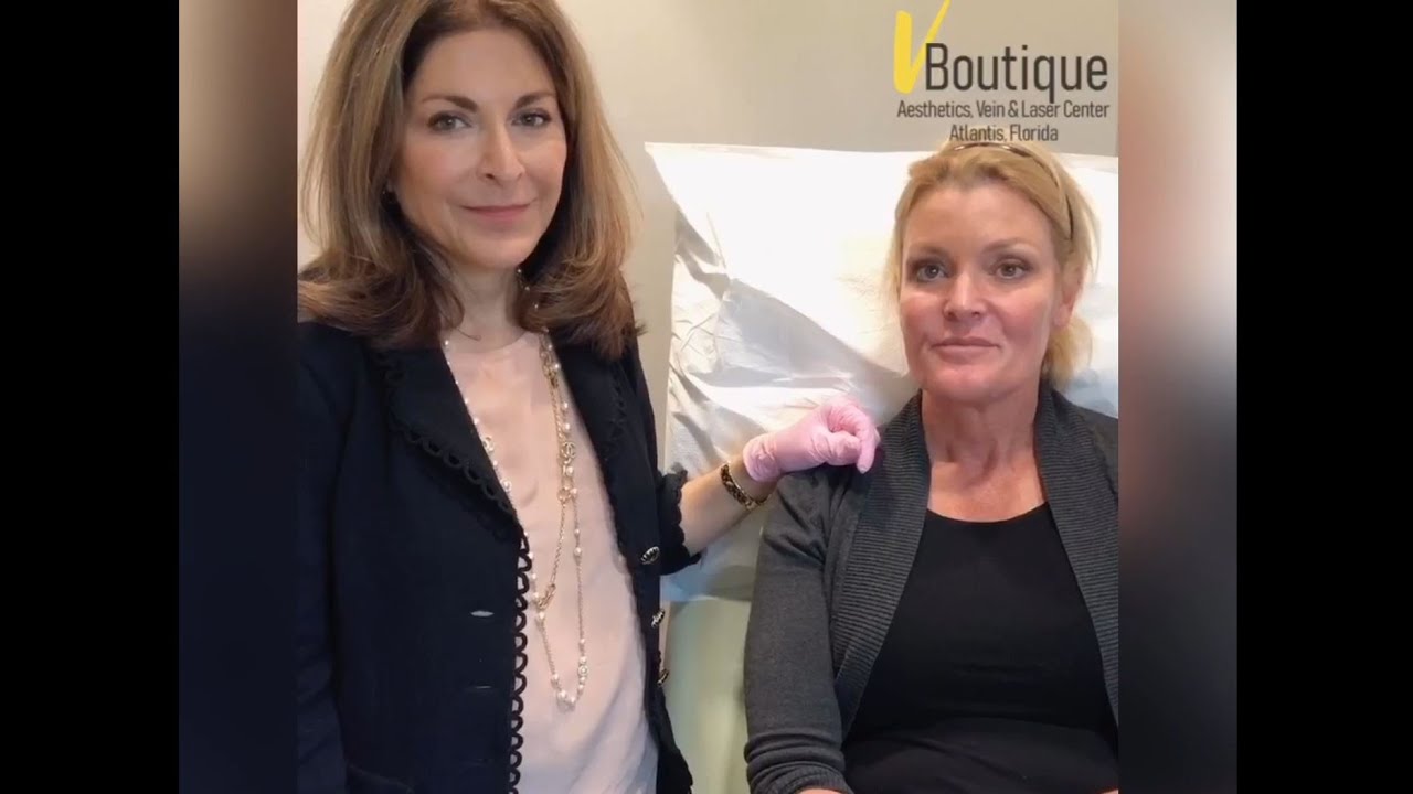 Radiesse Cheek Injections | Dermal Filler