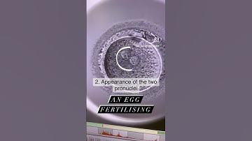 A fertilising egg in the IVF laboratory #embryologist #fertilityclinic #ivf #TTC #infertility