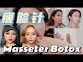 【Masseter Botox Before and After】My 4-year Experience & Here is What You Need to Know| 四年瘦脸针经验分享