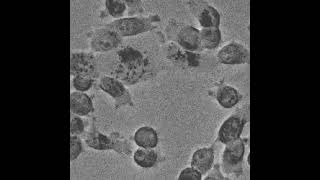 Time -Lapse Video Of Formation Of Polyploid Giant Cancer Cell