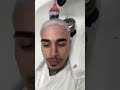 Trust the process 🧑🏼‍🦳🔥 Hair transformation by @miggyhair