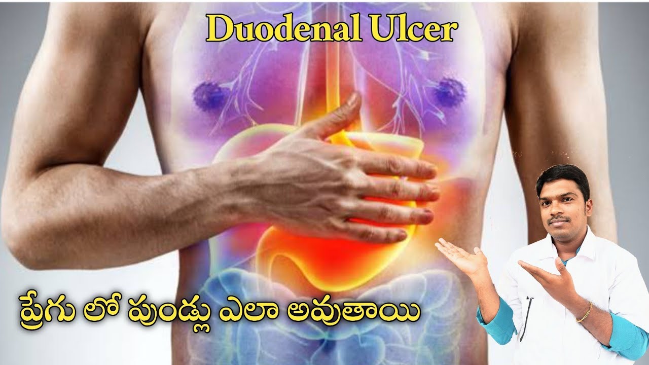 Deodunal Ulcer Stomach Ulcer In Telugu Peptic Ulcer Burning Deodunal Ulcer Stomach Ulcer In Telugu Peptic Ulcer Burning
