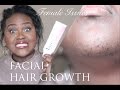 Female Issues: Excess Facial Hair Growth | My Facial Hair Routine | Chanel Boateng