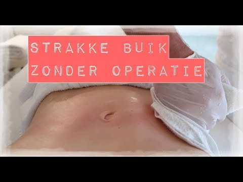 Video: Esthetische Behandelingen Zonder Operatie