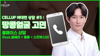 셀업!비대면상담소. 땅콜얼굴 고민 feat.울쎄라.볼륨.스킨부스터)