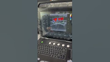 High-Quality Ultrasound Imaging | Real-time Scanning & Recording Demo