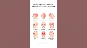 Os tipos de dor de cabeça que mais atingem as pessoas #shorts