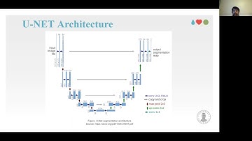 Automatic Polyp Segmentation using U-Net-ResNet50