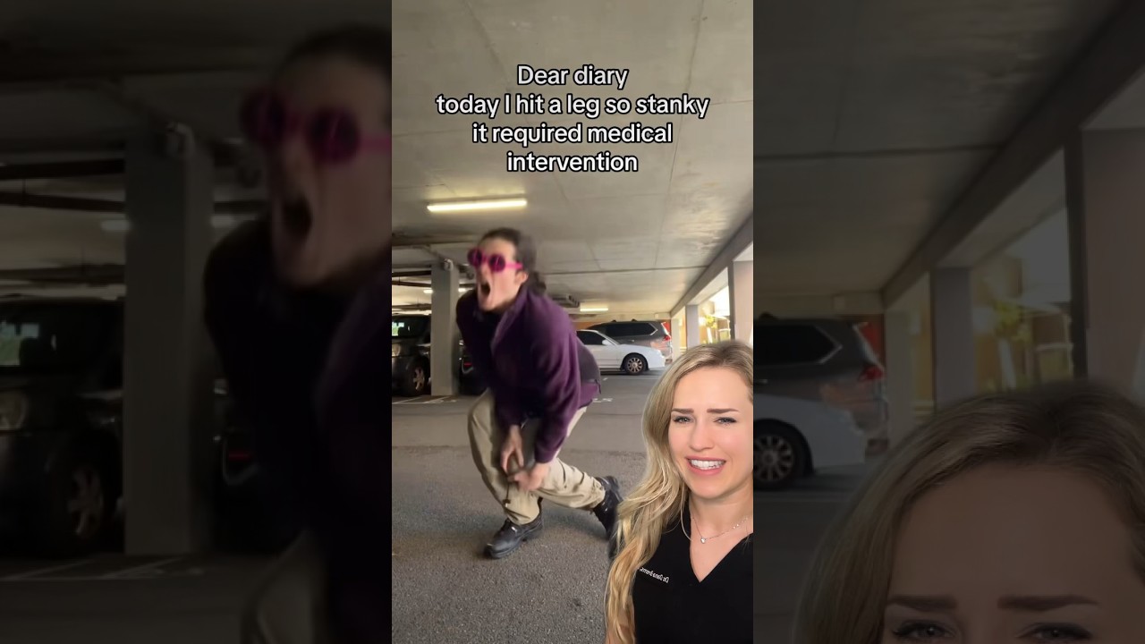 He took “break a leg” literally 😳