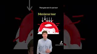 Meniscus tears can cause catching and locking in the knee. Surgery is sometimes needed