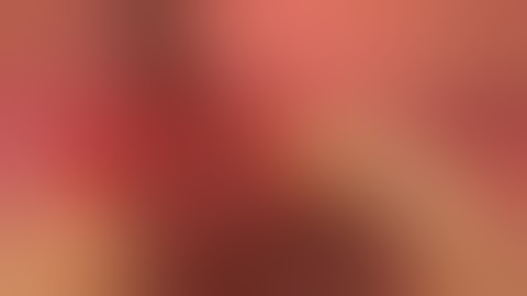 Ridge Augmentation followed by Delayed Implant Placement