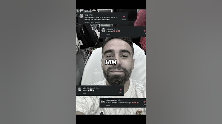 DANI CARVAJAL LEFT THE PITCH IN TEARS AFTER SUFFERING AN ACL INJURY 😥💔 RESPECT FOR REAL MADRID