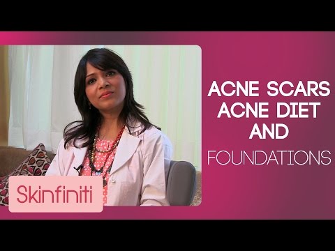 Acne Scars, Acne Diet & Foundations | #AskJaishree | Episode  | Skincare