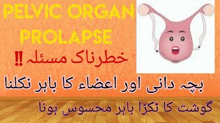 What is Pelvic Organ Prolapse ? Symptoms and treatment- Part 1 ( Urdu/Hindi) What is Pelvic Organ Prolapse ? Symptoms and treatment- Part 1 ( Urdu/Hindi)