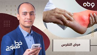 متى تكون سرعة الترسيب مصدر خطر لجسم الإنسان؟.. تعرف على الإجابة.. مع د. عبده اللبان