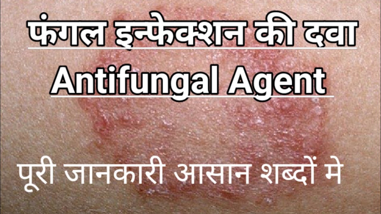 Fungal infection thik honi ki dava Antifungal agent dpharma bpharma 