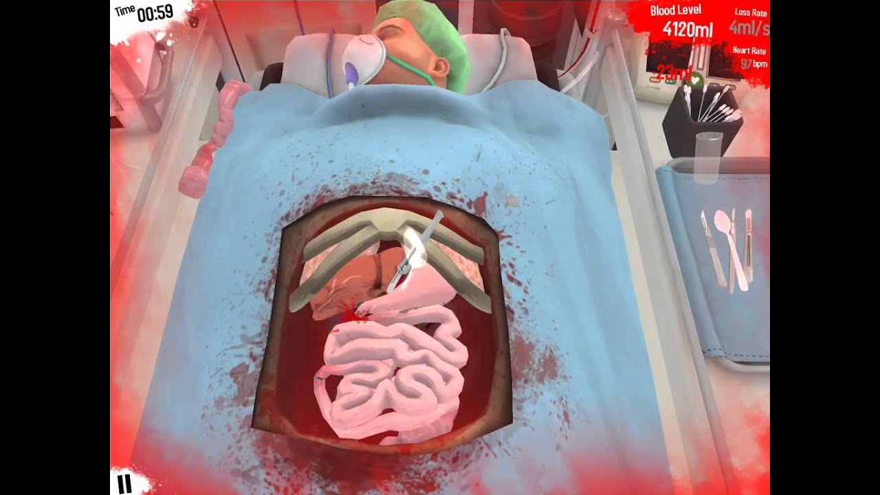 where to cut kidney transplant surgeon simulator