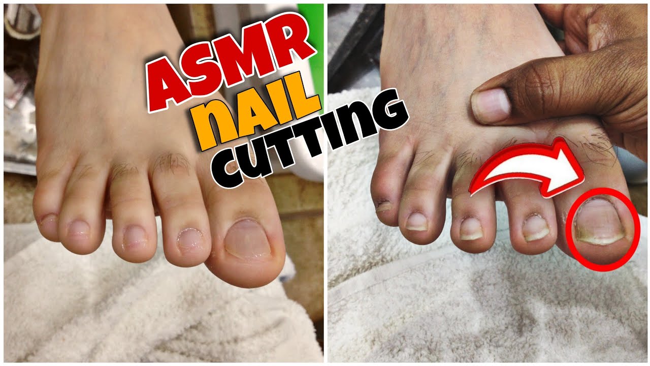 Getting the Australian 🇦🇺 boy ASMR! pedicure 💈😱 // Removing hard ...