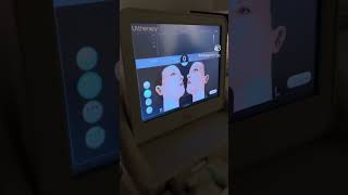 Stimulate Collagen Elastin With Our Non-Invasive Treatment, Ultherapy