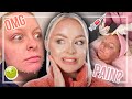 CHEMICAL PEEL &amp; BOTOX EXPERIENCE VLOG | VI PEEL PURIFY PRECISION PLUS + DYSPORT FIRST TIME! | MCDREW