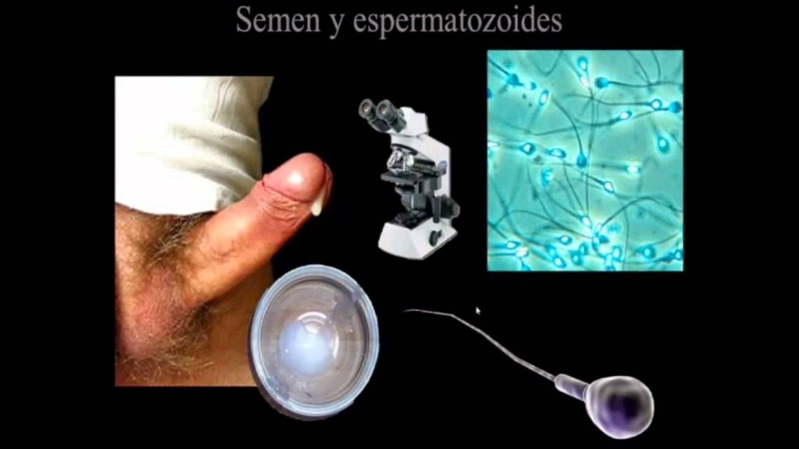 Cuanto cuesta una inseminación in vitro