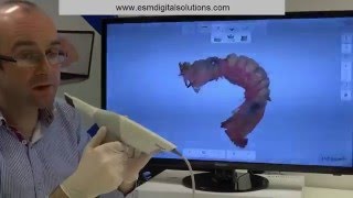 TRIOS   Full Arch Scanning Strategy Demonstrated