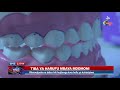 TIBA YA HARUFU MBAYA MDOMONI MWALE SAA MOJA TIBA YA HARUFU MBAYA MDOMONI MWALE SAA MOJA