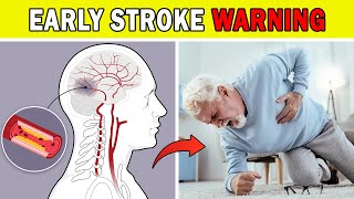 Stroke Alert: Could You Be Ignoring These Early Warning Signs?