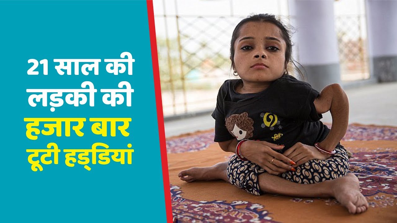 Sabal Parveen: This girl from Bihar has Broken 90% Bones In Her Body Over 1,000 Times