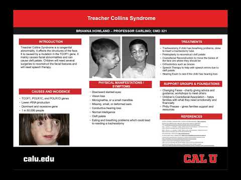 Treacher Collins Syndrome - Brianna Howland