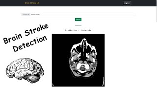 Brain Stroke Detection | Brain Tumor Detection | Image Classification | Segmentation | Deep Learning